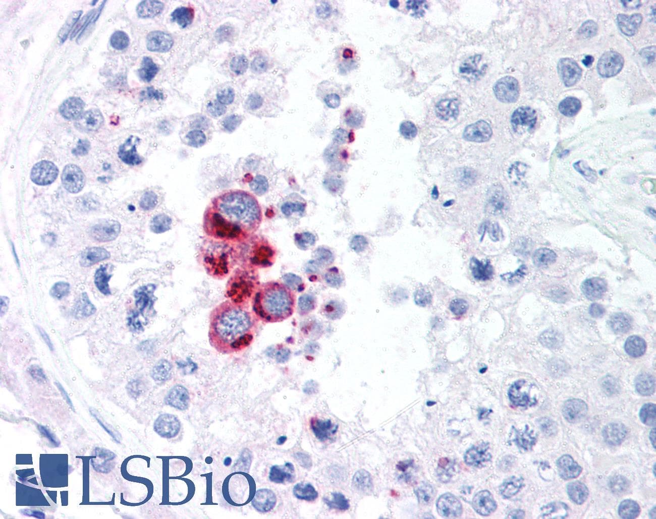 IHC-plus™ NAK / TBK1 Antibody (aa563-577, clone 108A429)