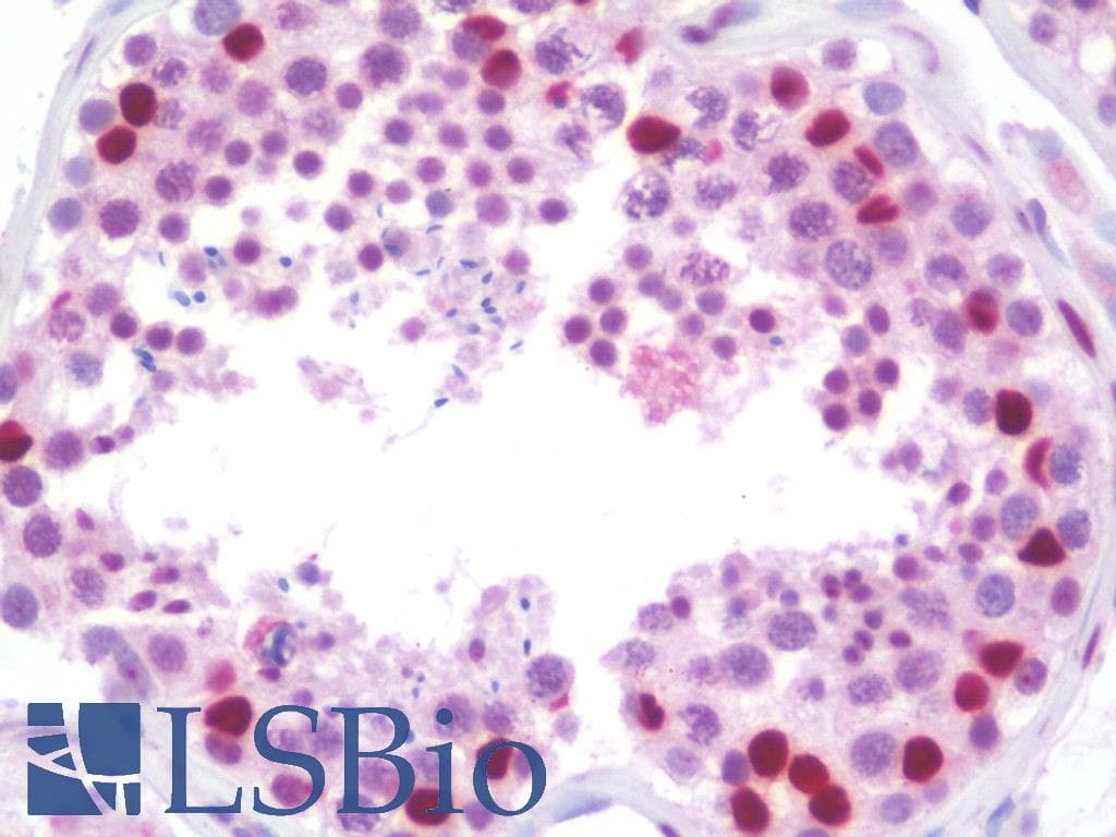 IHC-plus™ Polyclonal Rabbit anti-Human NRIP3 Antibody (aa192-241, IHC, WB)