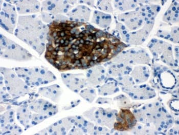 Polyclonal Rabbit anti-Human PRNP / PrP / Prion Antibody (IHC, WB)
