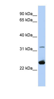 Polyclonal Rabbit anti-Human PLP1 / Myelin PLP Antibody (aa72-121, IHC, WB)