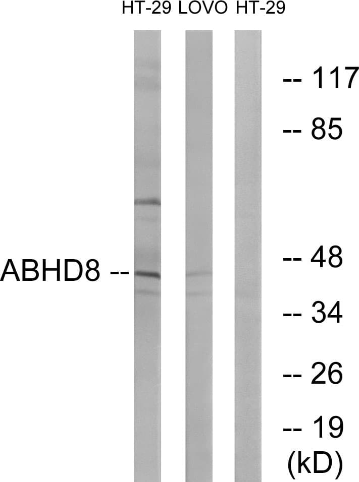 Polyclonal Rabbit anti-Human ABHD8 Antibody (aa291-340, WB)