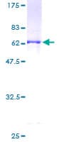 Human RD / PHYH Protein (Recombinant GST)