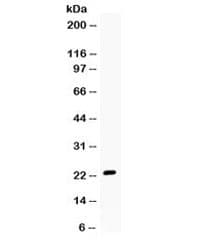 Polyclonal Rabbit anti-Human GREM1 / Gremlin-1 Antibody (WB)