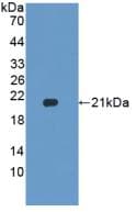 HPSE / Heparanase Antibody (aa40-188)