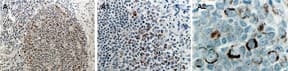 RIPK1 / RIP Antibody (aa269-287)