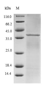 Human RBX1 / ROC1 Protein (Recombinant GST, N-terminus)