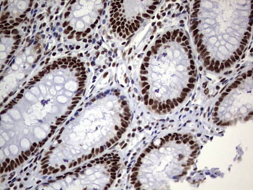 Monoclonal Mouse anti-Human PPP1R8 / Rnase E Antibody (clone OTI4E5, aa1-225, IHC, WB)