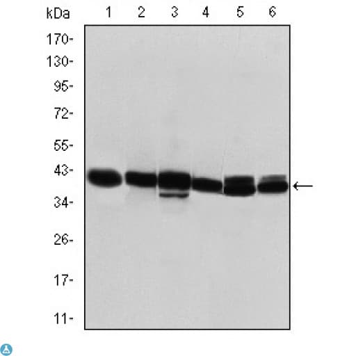 KRT19 / CK19 / Cytokeratin 19 Antibody
