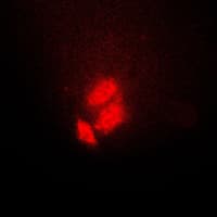 TSC22D1 / TSC22 Antibody (C-Terminus)