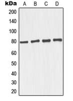 IHC-plus™ Polyclonal Rabbit anti-Human MAPT / Tau Antibody (C-Terminus, IHC, IF, WB)