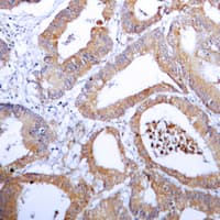 AKR1B1 / Aldose Reductase Antibody (C-Terminus)