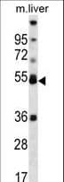 PPARA / PPAR Alpha Antibody (aa153-181)