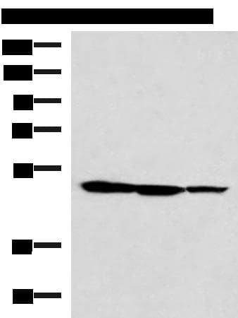 Polyclonal Rabbit anti-Human TTC38 Antibody (IHC, WB)