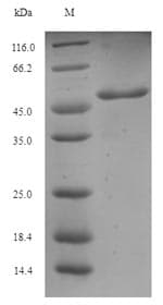 Aspergillus fumigatus AFUA_4G09580 Protein (Recombinant 6His-SUMO, N-terminus)
