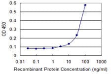 IHC-plus™ ERBB3 / HER3 Antibody (clone 2E9)
