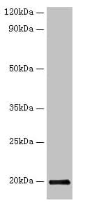 IFN Gamma / Interferon Gamma Antibody