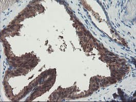 PGM3 Antibody (clone OTI1B8)