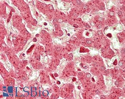 IHC-plus™ RANGAP1 Antibody (clone 1B4)