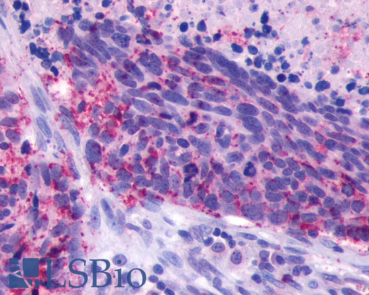 PathPlus™ ADGRF1 / GPR110 Antibody (N-Terminus)