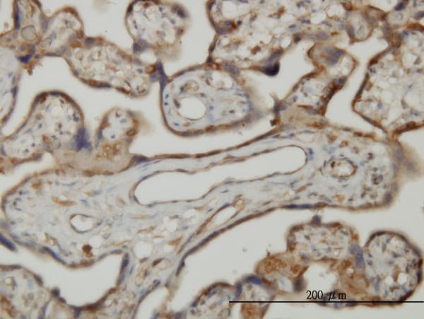 Monoclonal Mouse anti-Human SLK Antibody (clone 3E9, IHC, WB)