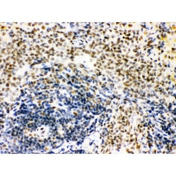 Polyclonal Rabbit anti-Human CTBP1 / CTBP Antibody (aa409-440, IHC, WB)