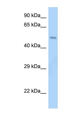 Polyclonal Rabbit anti-Mouse SCHIP1 Antibody (aa80-129, WB)