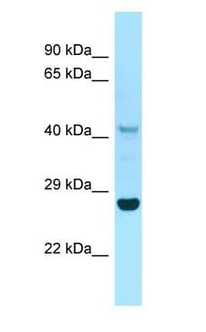 Polyclonal Rabbit anti-Human IDO1 / IDO Antibody (C-Terminus, WB)