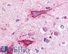 PathPlus™ VRL1 / TRPV2 Antibody (N-Terminus)