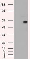Monoclonal Mouse anti-Human NRBP1 / NRBP Antibody (clone OTI7E2, IHC, WB)