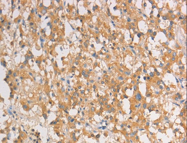 ART3 Antibody