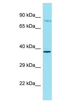 ARHGEF37 Antibody (aa607-656)