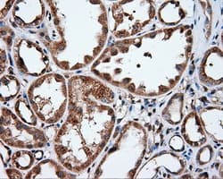 IFIT1 / ISG56 Antibody (clone OTI3G8)