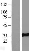 TTC33 Protein (Over-Expression Lysate Myc-DDK (Flag))
