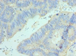 ELF4 / MEF Antibody (aa1-200)
