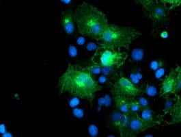 FXYD3 Antibody (clone OTI1F12)
