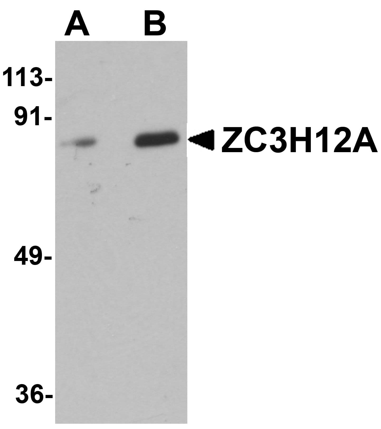 Polyclonal Rabbit anti-Human ZC3H12A / MCPIP1 Antibody (WB)