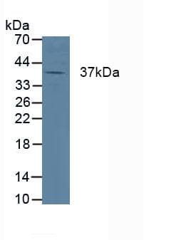 CTSK / Cathepsin K Antibody (aa54-317)