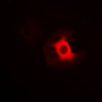 PRKAG1+2+3 Antibody
