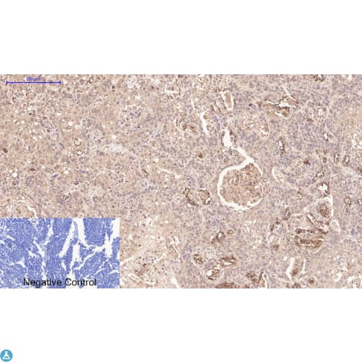 Monoclonal Mouse anti-Human TUBG1 / Tubulin Gamma 1 Antibody (IHC)