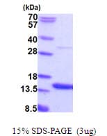Human AAMDC Protein (Recombinant His)