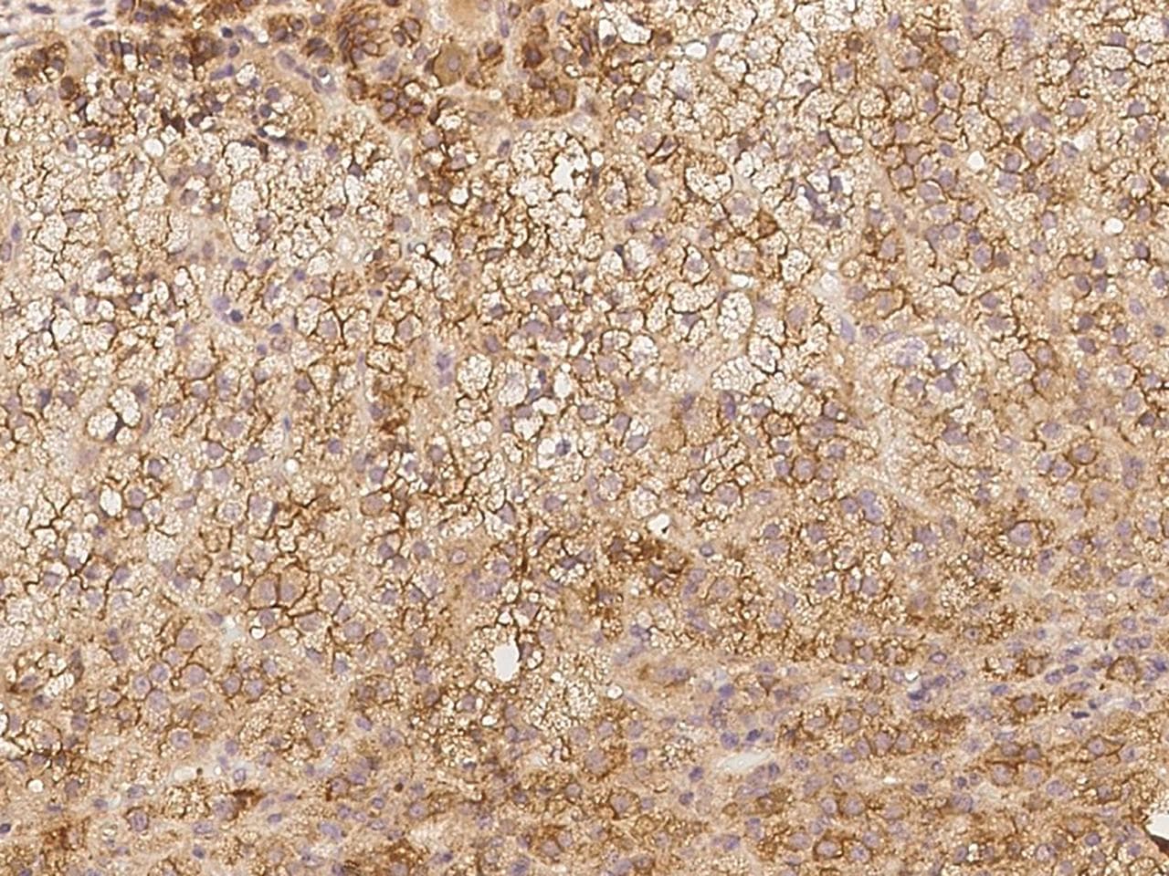 Polyclonal Rabbit anti-Human CNST Antibody (IHC)