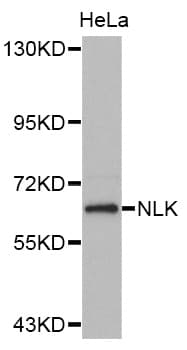 Polyclonal Rabbit anti-Human NLK Antibody (IHC, WB)