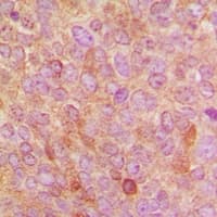 CYP24 / CYP24A1 Antibody (C-Terminus)