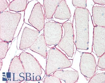 IHC-plus™ SGCA / DAG2 Antibody