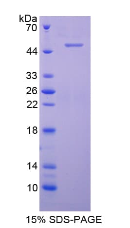 Rabbit Complement C9 Protein (Recombinant His-T7)