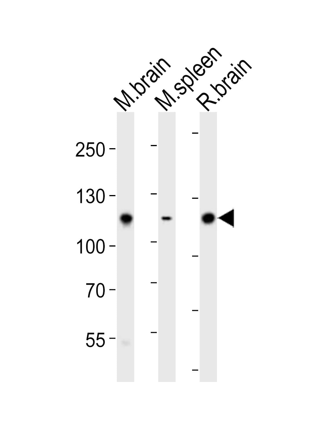 Polyclonal Rabbit anti-Mouse PTK2B / PYK2 Antibody (aa769-802, WB)