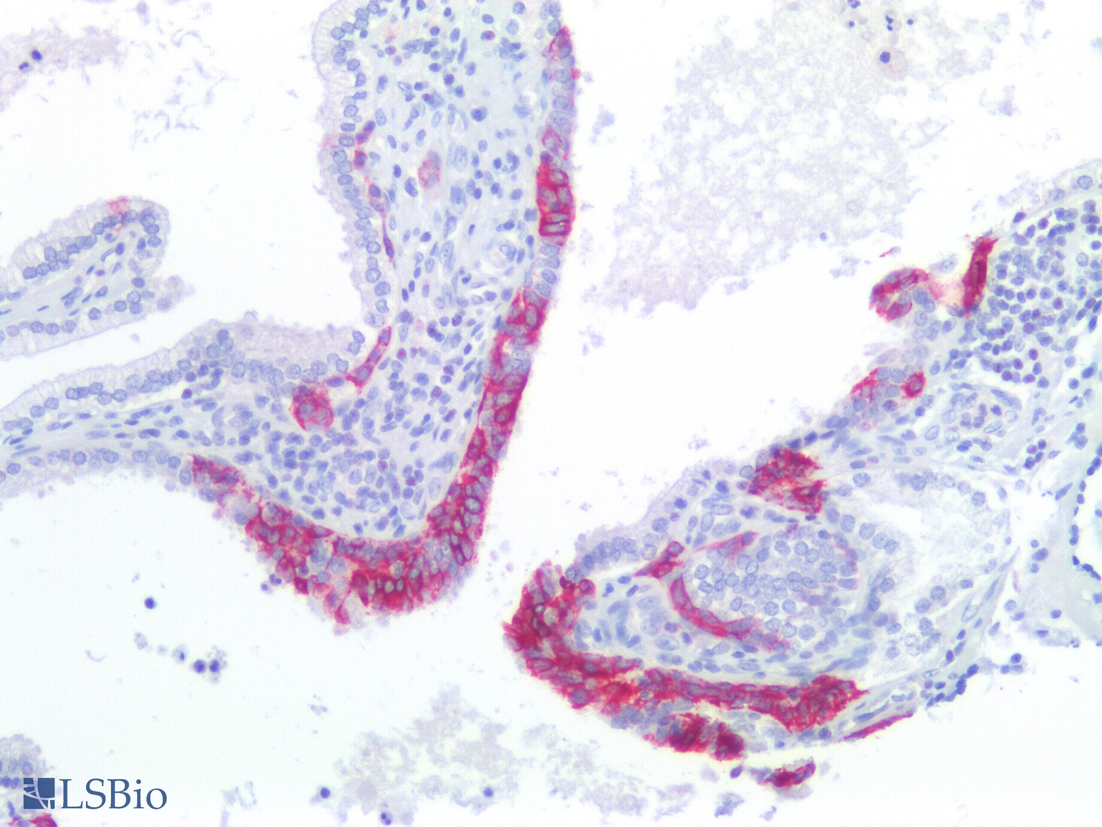 IHC-plus™ KRT17 / CK17 / Cytokeratin 17 Antibody (C-Terminus)