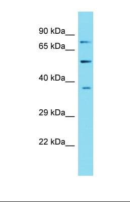 Polyclonal Rabbit anti-Mouse GPRC5D Antibody (C-Terminus, WB)