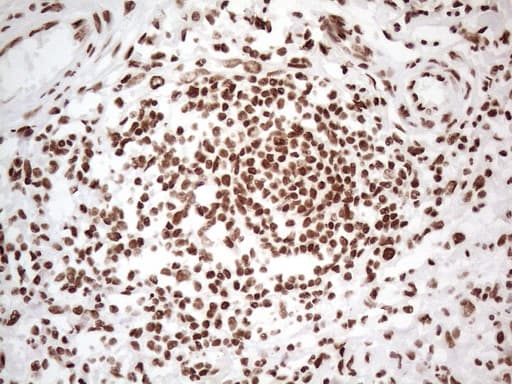 Monoclonal Mouse anti-Human HNRNPL / hnRNP L Antibody (clone OTI4E5, aa270-502, IHC)