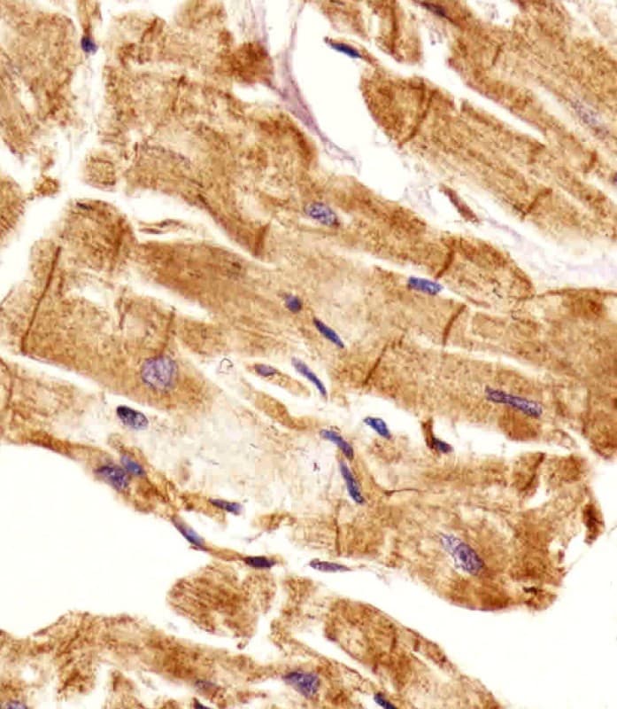 Polyclonal Rabbit anti-Human EHD2 Antibody (aa415-449, IHC, WB)